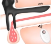 Kablosuz Kumandalı 20 Modlu Klitoris ve G Spot Uyarıcı Testis ve Penis Halkası